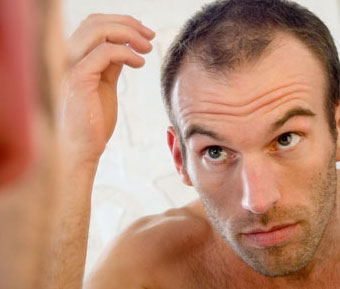 hair-loss-due-to-stress